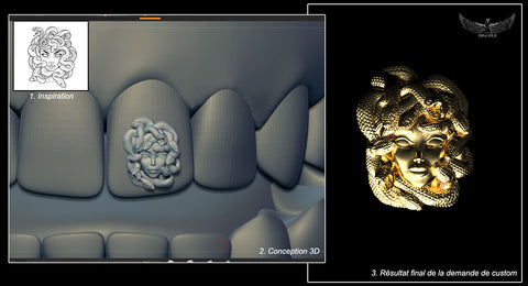 Gold grillz: complete guide to types, prices, and custom options