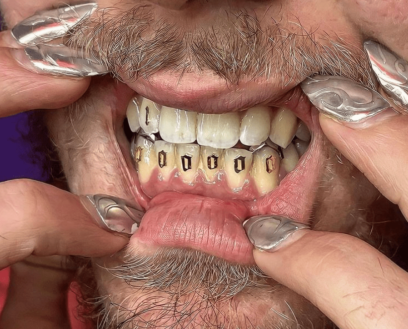 Teeth jewelry tooth gems