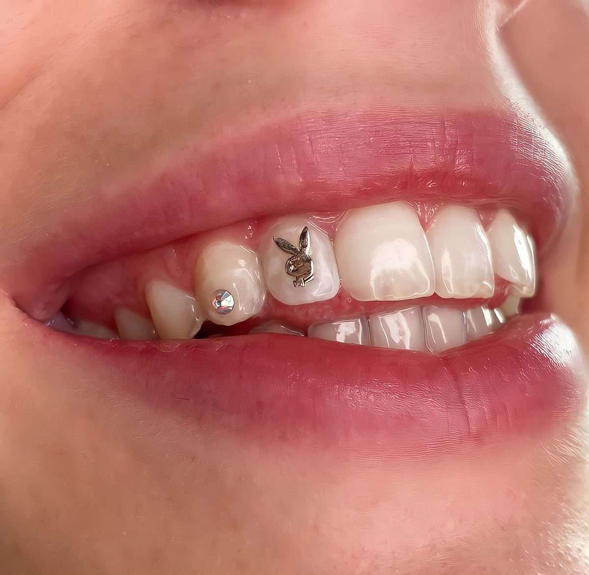 Tooth Gems: All You Should Know About Teeth Jewelry