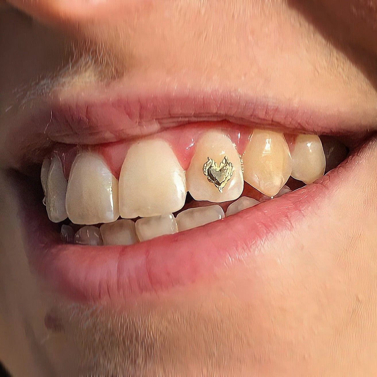 Classic Tooth Gems