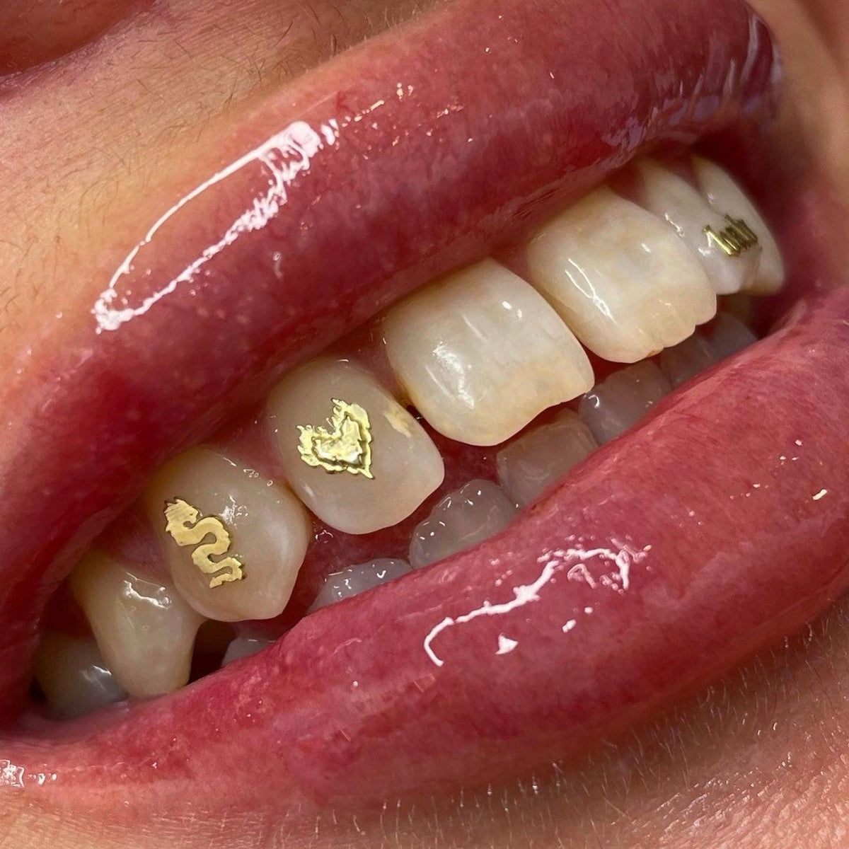Dental tooth gems, sparkles and gold tooth jewelry? So much choice we have!