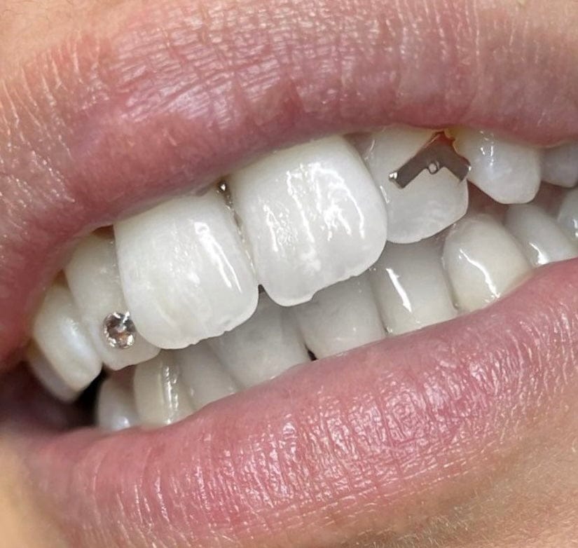 Bijoux dentaire Isis&gold Gun tooth gems