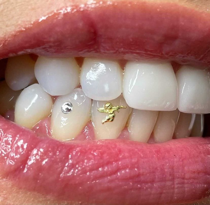 Tooth gems, gold innocent angel teeth jewelry