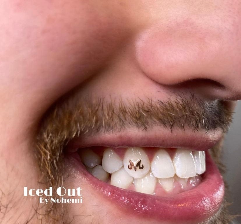 Teeth Jewelry Tooth gems