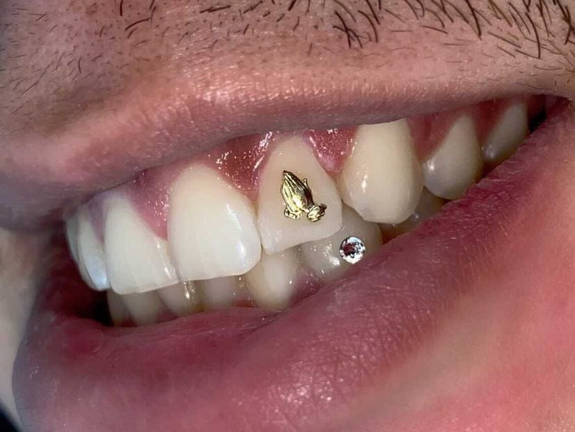 Bijoux dentaire Isis&gold Praying Hands tooth gems