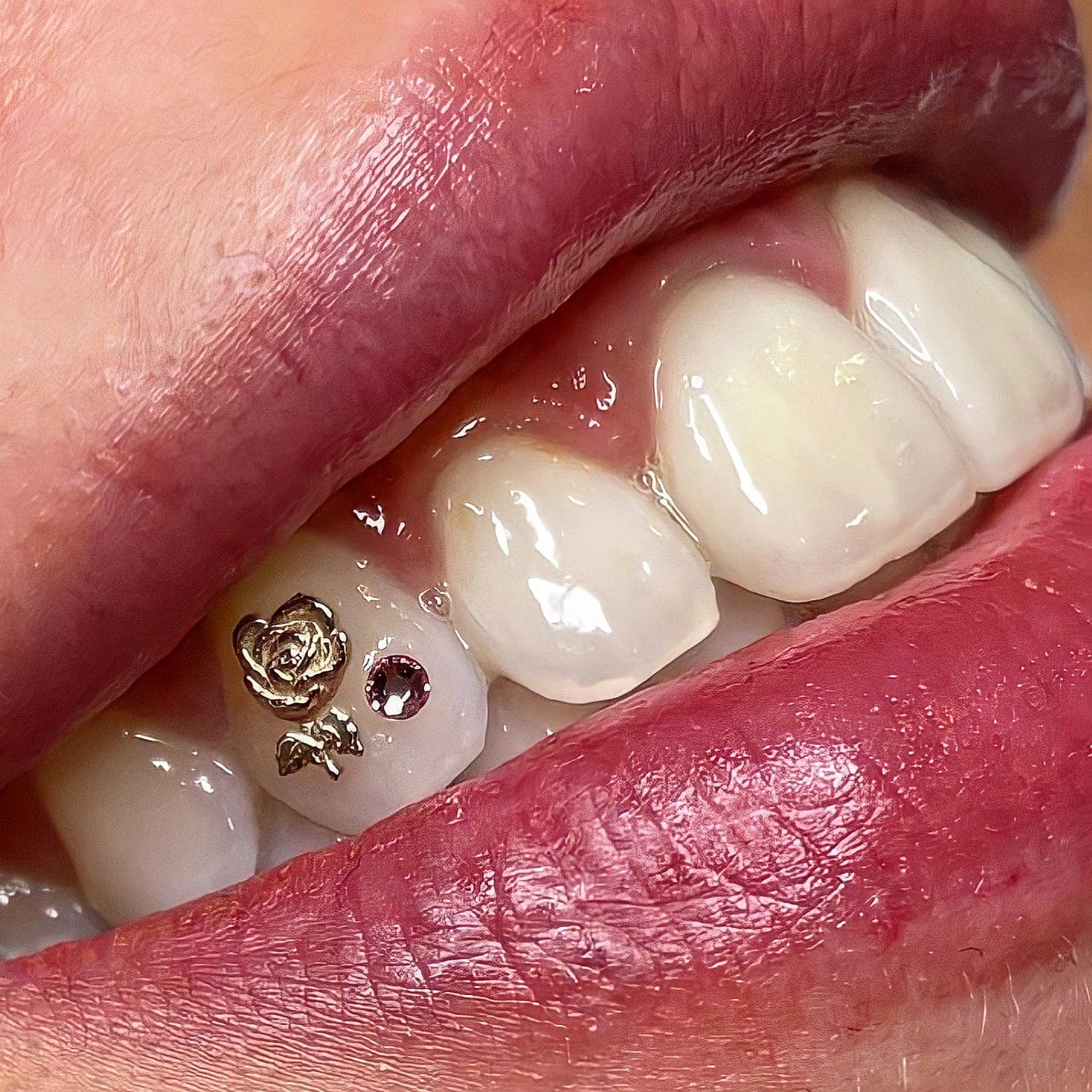 Bijoux dentaire Isis&gold Rose tooth gems